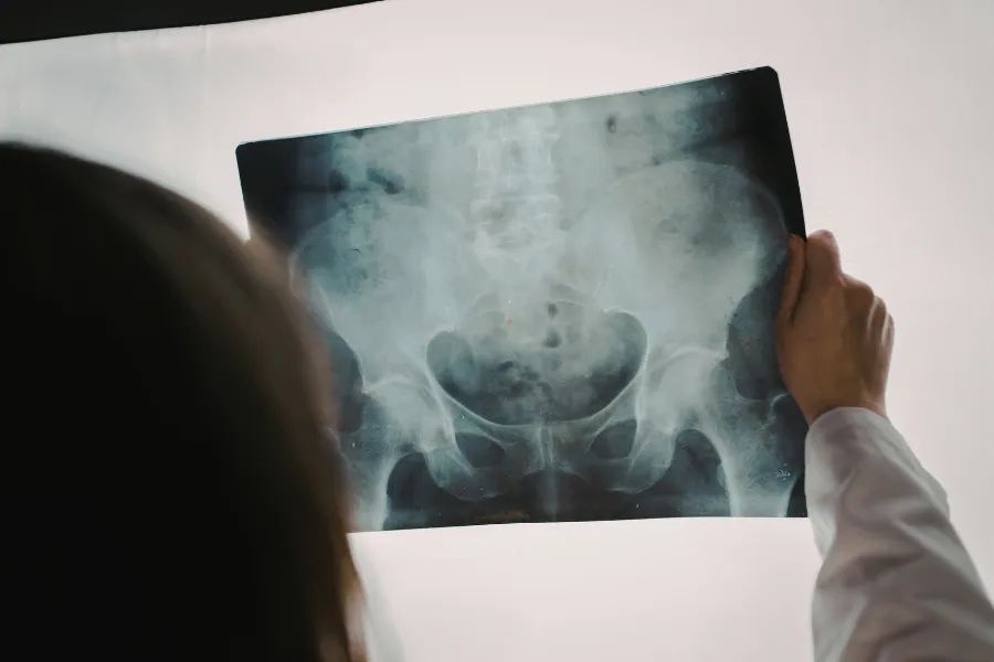 Hip diagram